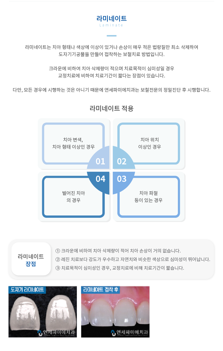 라미네이트 치아-형태나-색상에-이상이-있거나-손상이-매우-적은-법랑질만-최소-삭제하여-도자기기공물을-만들어-접착하는-보철치료-방법입니다.