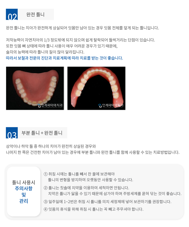 완전틀니, 부분틀니+완전틀니