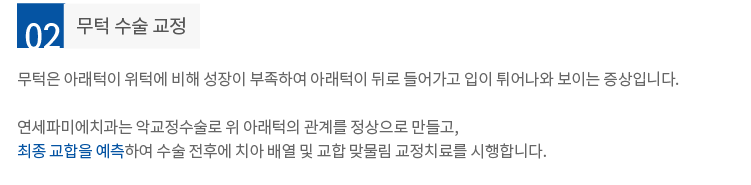 무턱-수술-교정