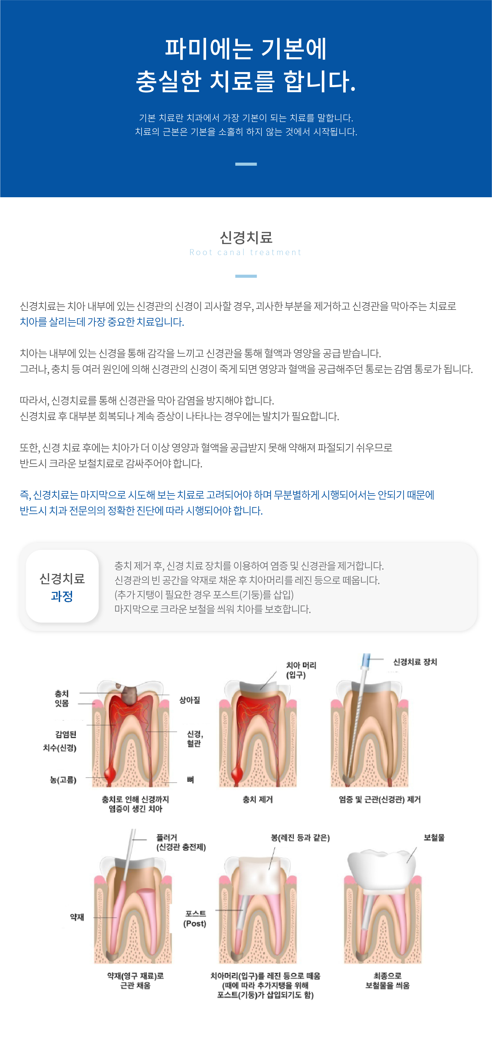 신경치료 신경치료는-무분별하게-시행되어서는-안되기-때문에-반드시-치과-전문의의-정확한-진단에-따라-시행되어야-합니다.