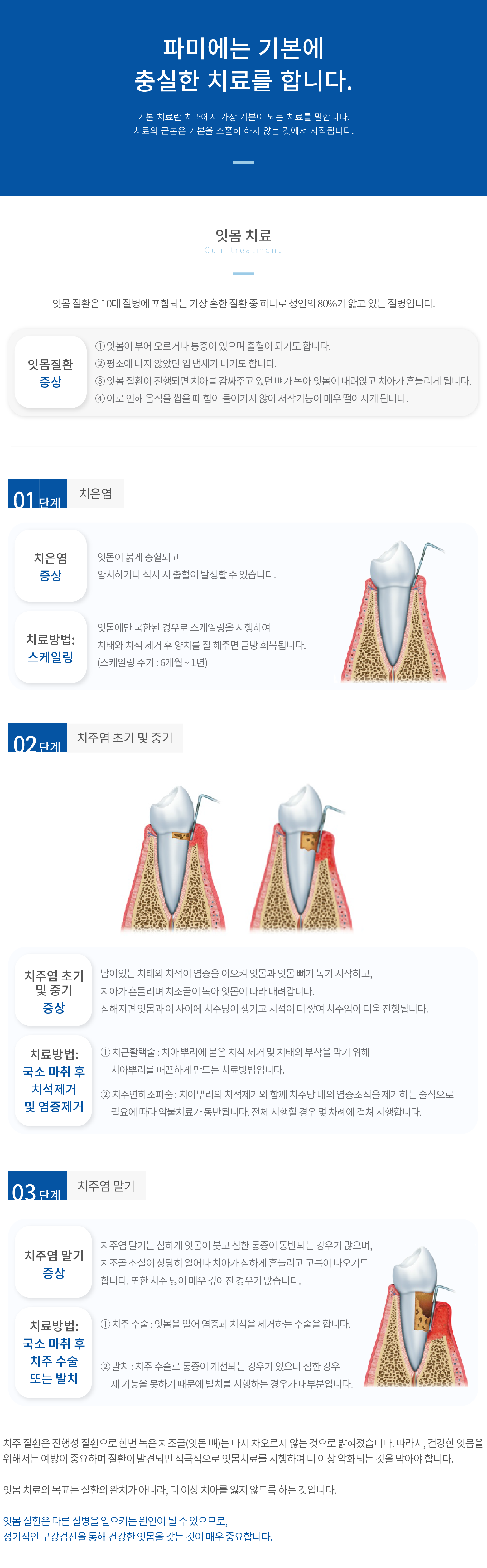 잇몸치료 치은염 치주염-초기-및-중기 치주염-말기